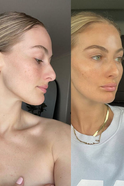 before for and after self tan for face